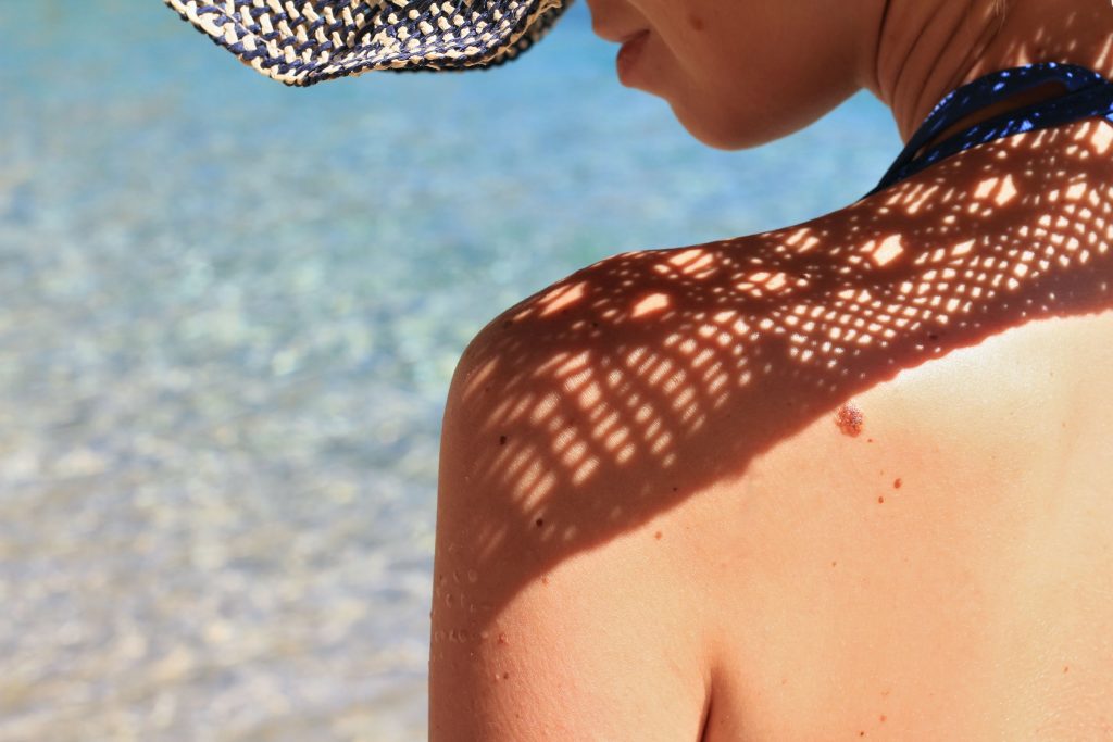 What is Skin Cancer, and How Does It Occur? And What are the Common Types of Skin Cancer?