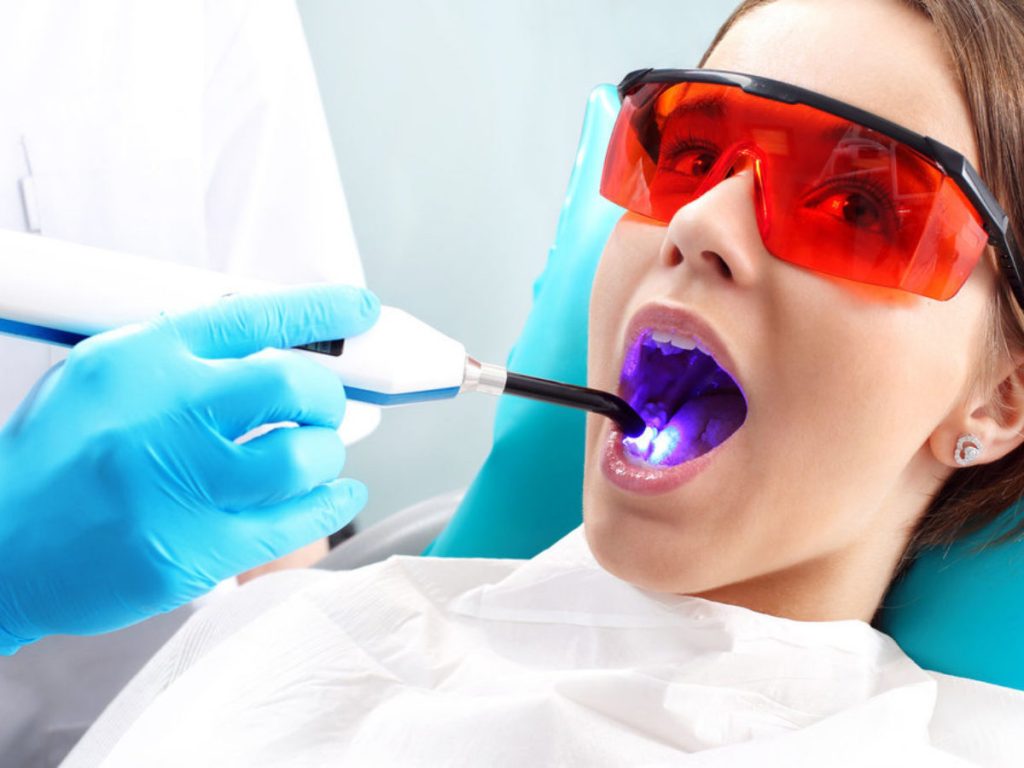 What Are the Benefits of Laser Dentistry Over Traditional Dentistry?