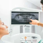 What Orthodontists Look For On X Rays And Cephalometric Images